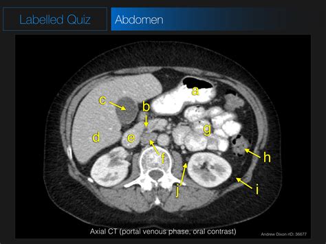 Mri Anatomy Practice At Terry Dubreuil Blog