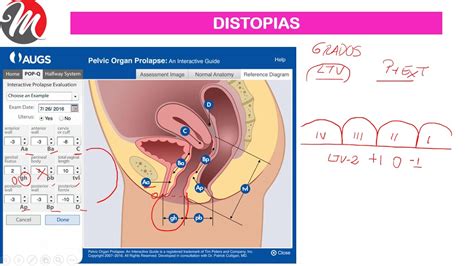 Distopias Pop Q Youtube