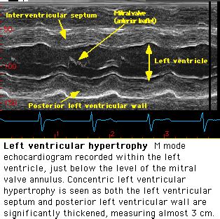 Lv Dimensions Echo Literacy Basics