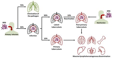 Tuberculosis Treatment And Impact Of Drug Delivery Systems