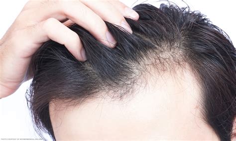 Tips para mabilis tumubo ang buhok