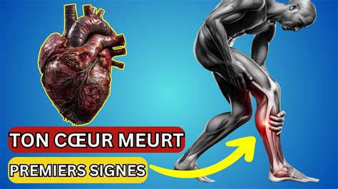 Signes Insoup Onn S Que Votre Coeur Est En Danger Agissez Vite