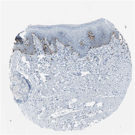 Tissue Expression Of DCT Staining In Skin The Human Protein Atlas