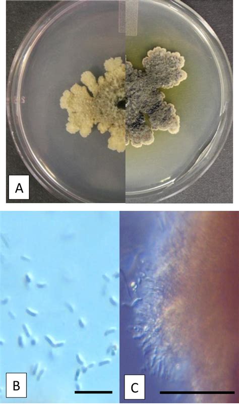 Figure 1 1 From Identification Of Cytospora Species Isolated From