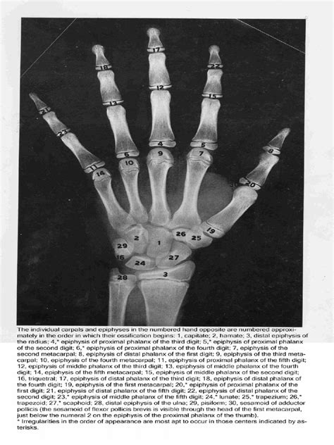 bone age greulich pyle hand wrist atlas