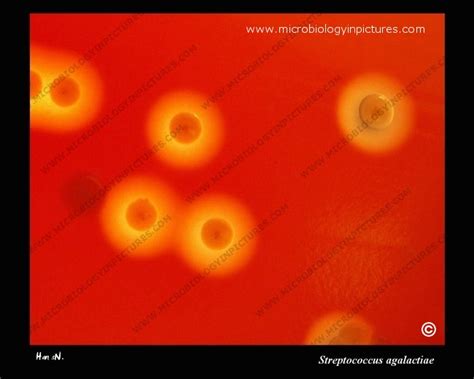 Streptococcus agalactiae photograph. Colonies with hemolysis growing on ...