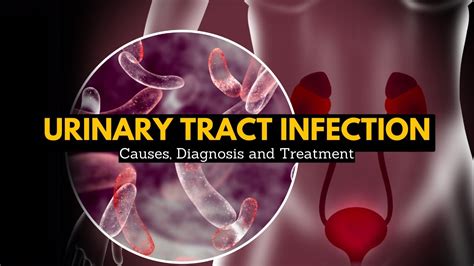 Urinary Tract Infection Causes Signs And Symptoms Diagnosis And Treatment Youtube