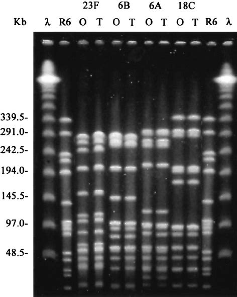 Pulsed Fi Eld Gel Electrophoresis Patterns Generated By Smai Digestion