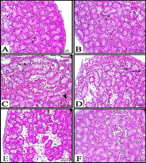 Photomicrographs Of Transverse Sections In The Testes Of Control A