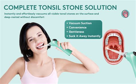 Electronic Vacuum Tonsil Stone Remover Tonsil Stone Removal Kit With