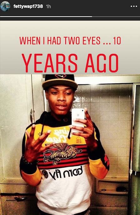 Fetty Wap Posts Throwback Photo Showing Off Prosthetic Eye – WESTCOASTHIPHOP.COM