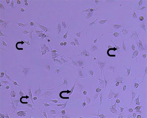 An Inverted Microscope Micrograph On Day 14 From Primary Culture Of Download Scientific Diagram