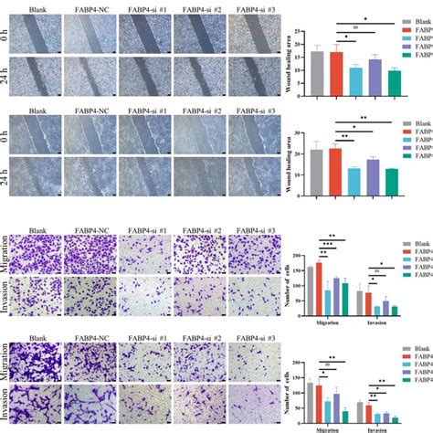 Knock Down Of Fabp4 Inhibits The Migration And Invasion Of Cervical Download Scientific Diagram