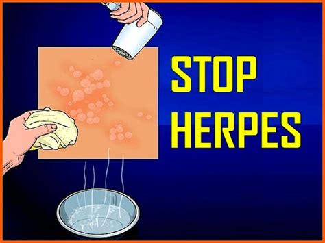 4 Tips Mencegah Penyakit Herpes Zoster