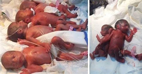 Une Jeune Maman De Ans Donne Naissance Des Septupl S En Irak Apr S