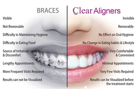 Clear Aligners Dental On Main