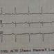 Baseline Electrocardiogram Showing Normal Sinus Rhythm With Left