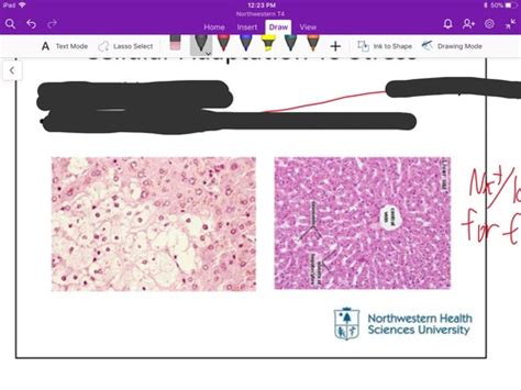 Cellular Adaptation To Stress Flashcards Quizlet