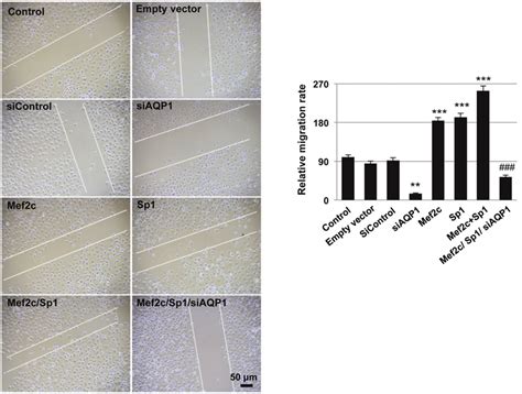 Mef C Promotes Huvec Migration Through Aqp A Huvec Cells