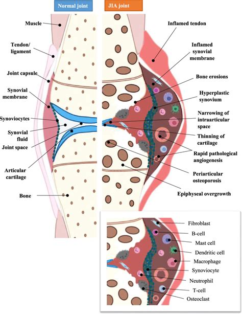 Synovial Membrane Diagram