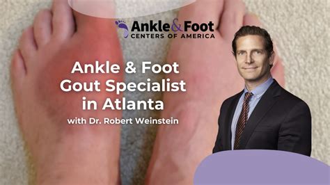 Ankle & Foot Gout Specialist in Atlanta | Rob Weinstein DPM