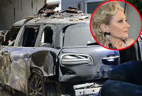 Sufre Grave Accidente La Actriz Anne Heche