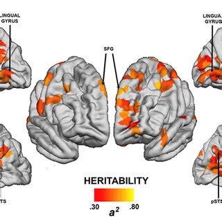 Cortical Regions Showing Statistically Significant P