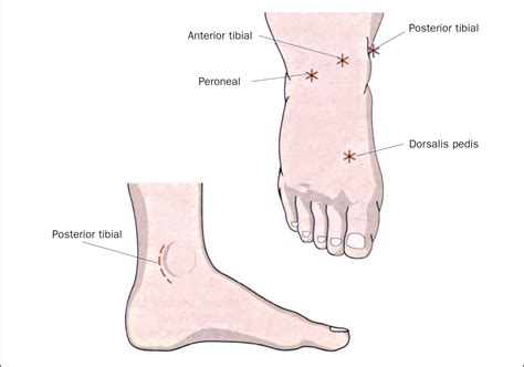 British Journal Of Nursing Lower Limb Assessment