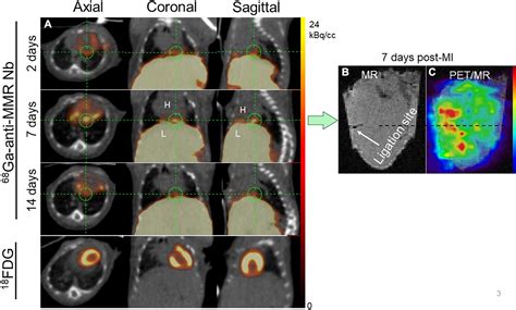 Frontiers In Vivo Visualization Of M Macrophages In The Myocardium