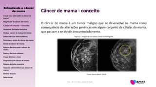 Aula 1 Entendendo O Cancer De Mama 2018 PPT