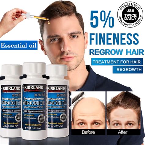 Original Kirkland Signature Minoxidil Extra Strength Hair Regrowth