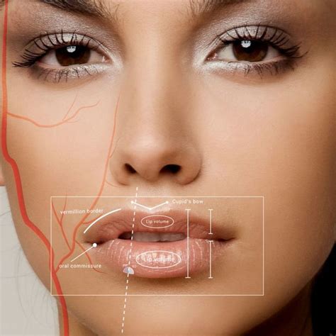 Top 3 BOTOX Injection Patterns Markup SkinViva Training Botox