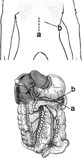 Surgical landmarks. Incision: (a) indicates midline incision and (b ...