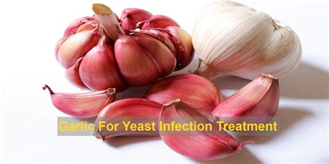 Garlic For Yeast Infection Treatment Your Health Orbit