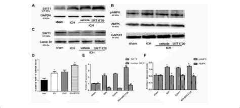 Sirt Expression And Localization After Ich And Srt Treatment