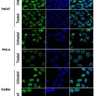 Fig Latex Treatment Inhibits Colony Formation In Cervical Cells A