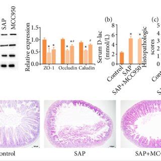 Protective Effect Of Mcc On Intestinal Injury In Acute Pancreatitis