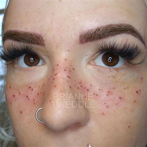 People Are Tattooing Freckles On Their Face And This Is What It Looks Like