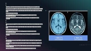 Bioseguridad En Resonancia Magn Tica Pptx