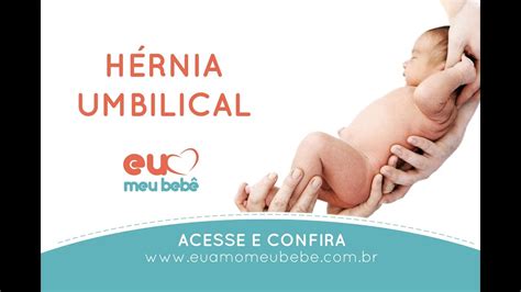 Hérnia Umbilical No Bebê Como Reconhecer E Tratar Youtube