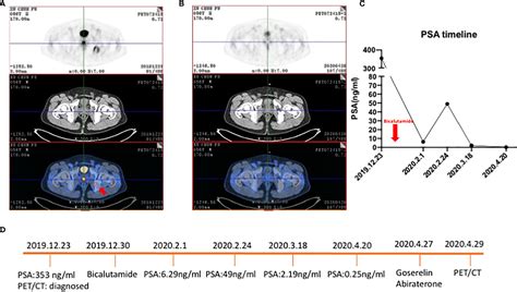 Frontiers The Evolving Role Of 18F FDG PET CT In Diagnosis And