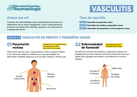 Vasculitis qué es síntomas diagnóstico y tratamiento