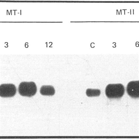 Northern Blot Hybridization Analysis Of MT I And MT Il MRNAs In Control