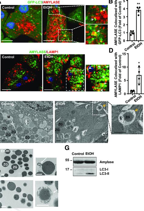 Alcohol Increases Colocalization Of ZGs With Autophagic Vacuoles Male