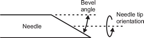 Definition of the bevel tip angle and needle orientation. | Download ...