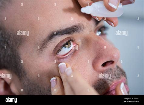 Poniendo gotas para los ojos fotografías e imágenes de alta resolución