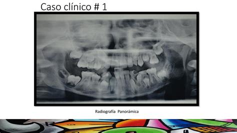 Manejo Del Proceso Infeccioso By Jmor Her Issuu