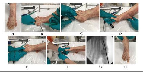 Figure From Risk Of Damaging Anatomical Structures During Minimally