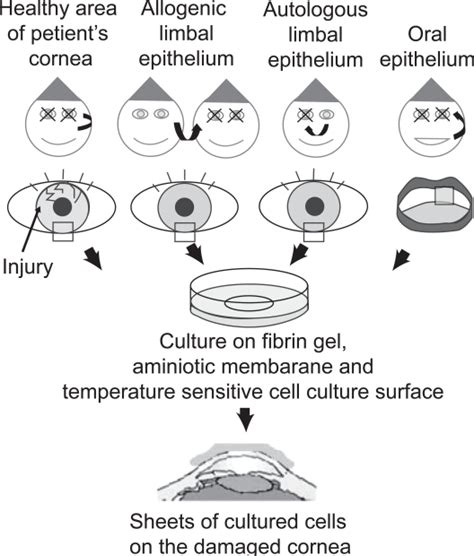 Corneal Regeneration By Using Cell Sheets Made Of Cultured Corneal