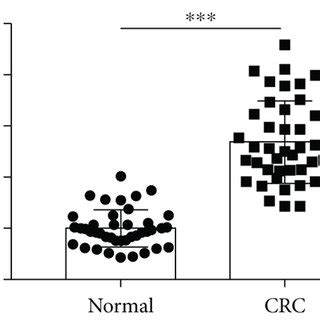 Circ Was Upregulated In Colorectal Cancer Tissues And Cell